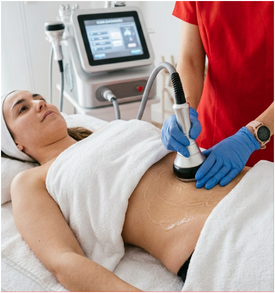 Sesión Cavitación + Presoterapia